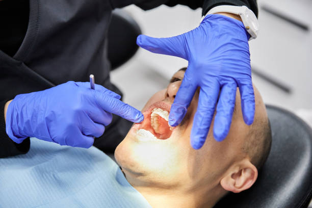Best Emergency Treatment for Dental Infections or Abscesses in Hermiston, OR